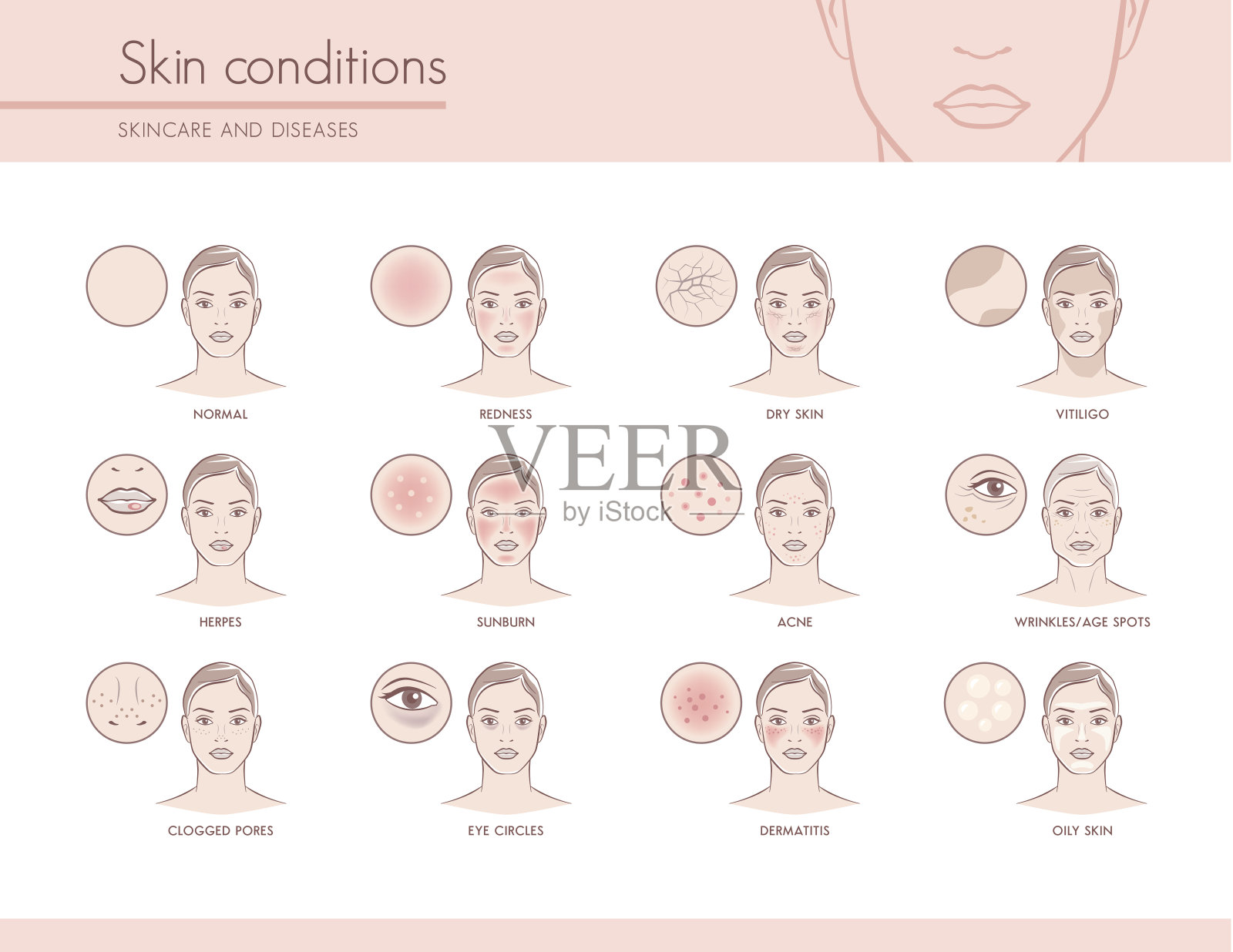 皮肤状况插画图片素材