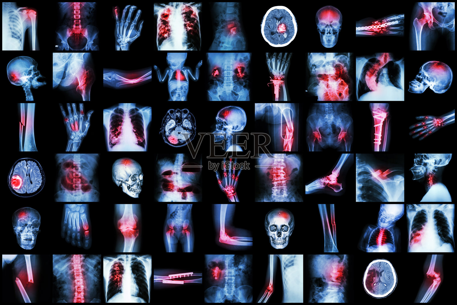 儿童及成人多发性疾病的x线检查照片摄影图片