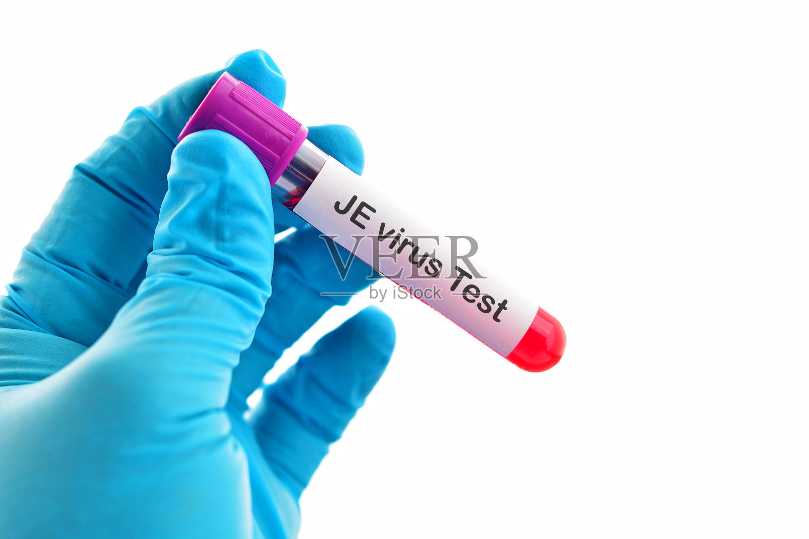 日本脑炎(JE)病毒试验照片摄影图片