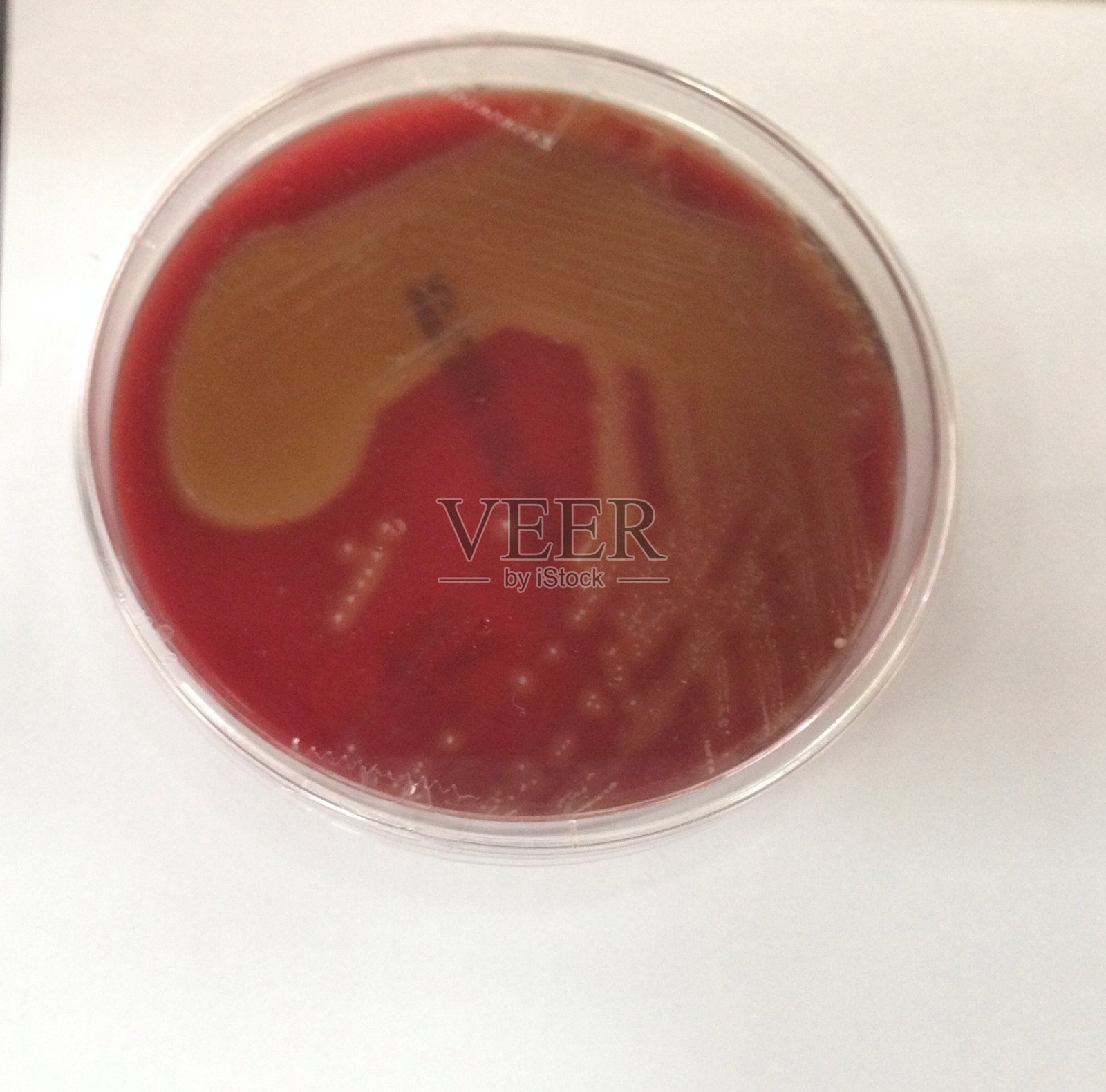 血琼脂上的-溶血照片摄影图片