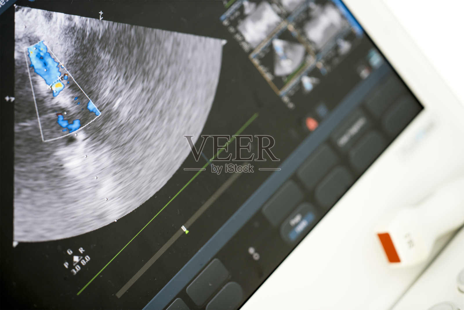 现代超声机照片摄影图片