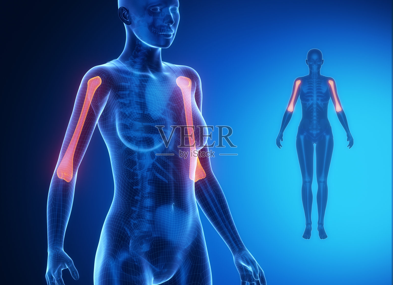 肱骨蓝x线骨扫描照片摄影图片