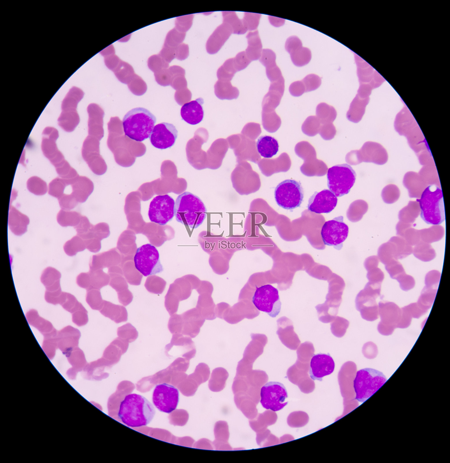 医学背景:红细胞。照片摄影图片
