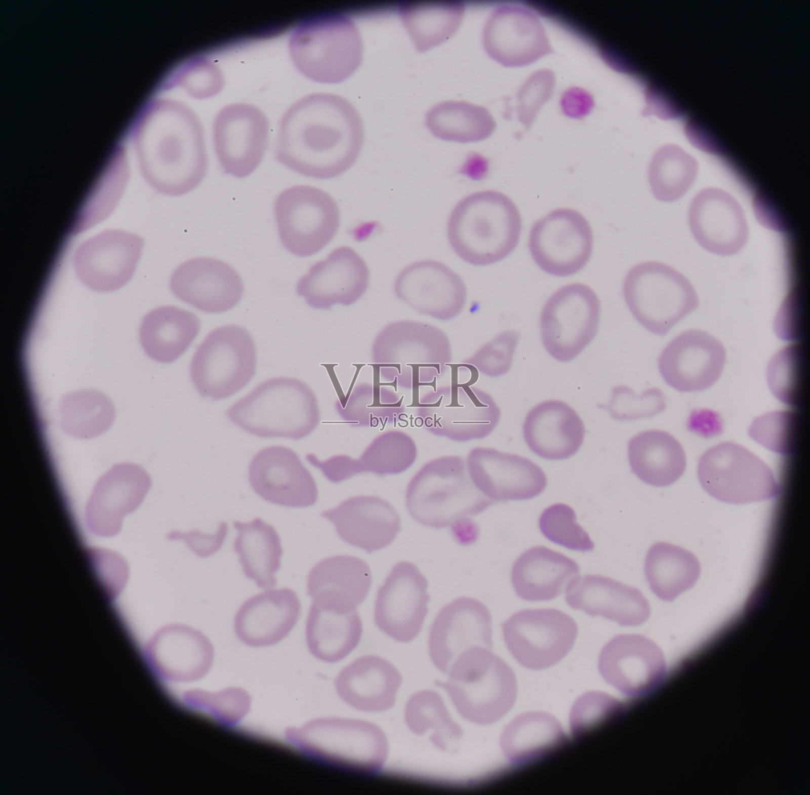 血液涂片医学背景照片摄影图片