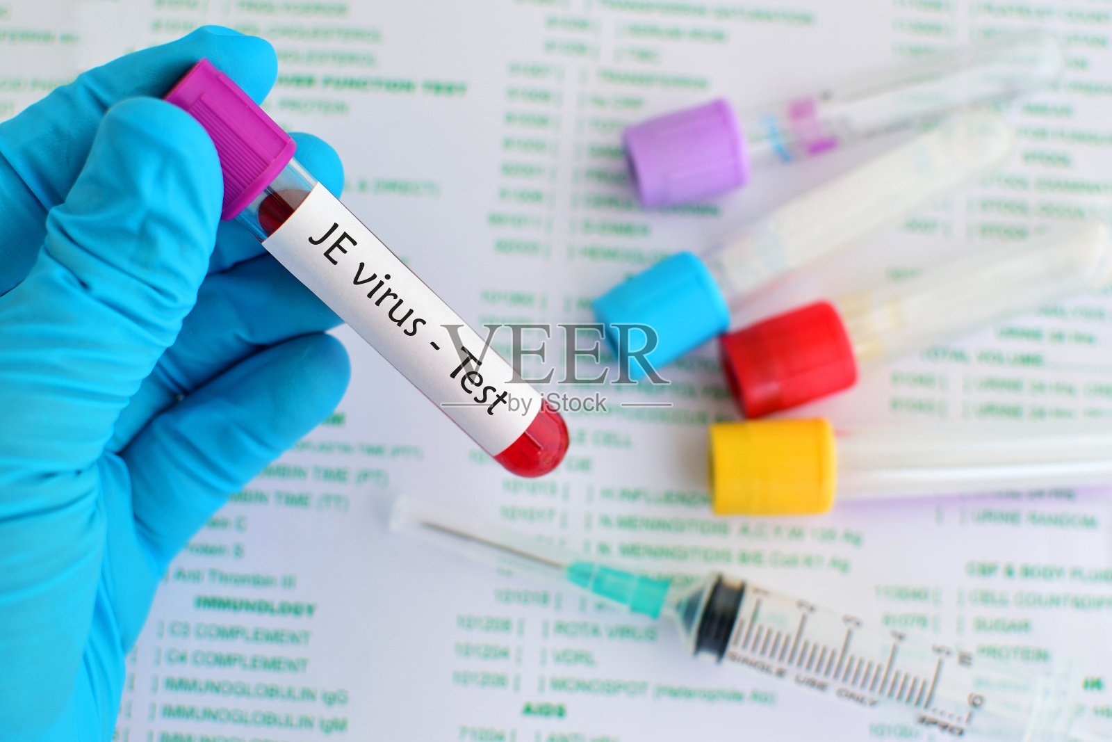 乙脑病毒测试照片摄影图片