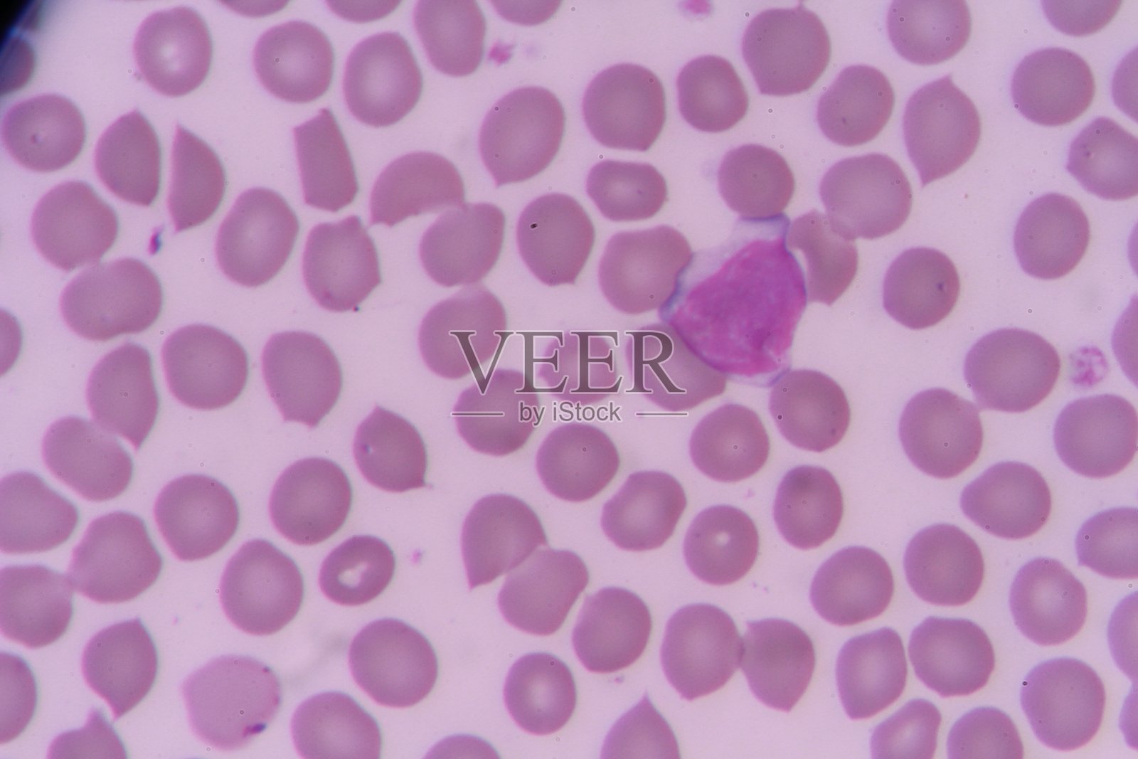 淋巴细胞照片摄影图片