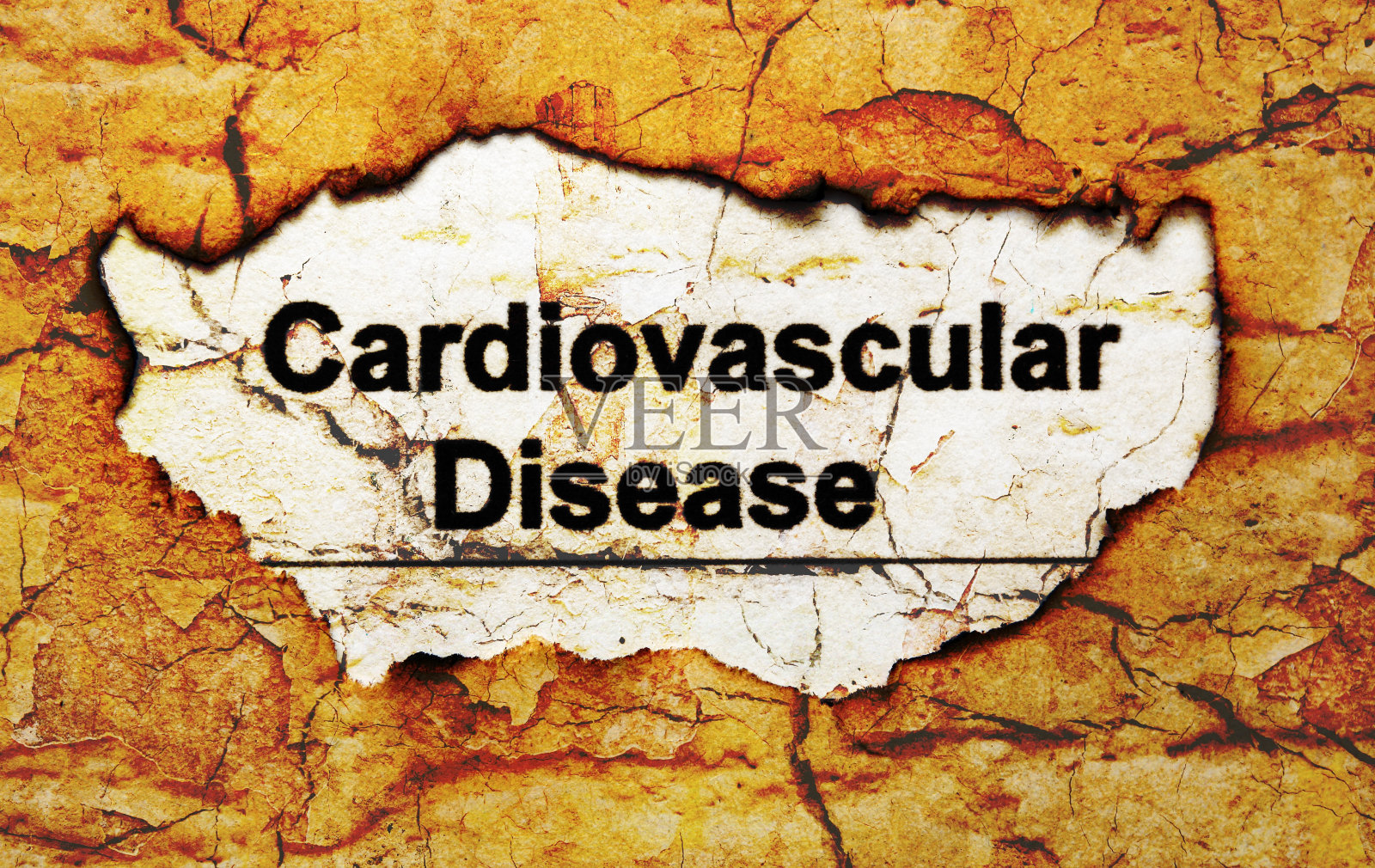 心血管病照片摄影图片