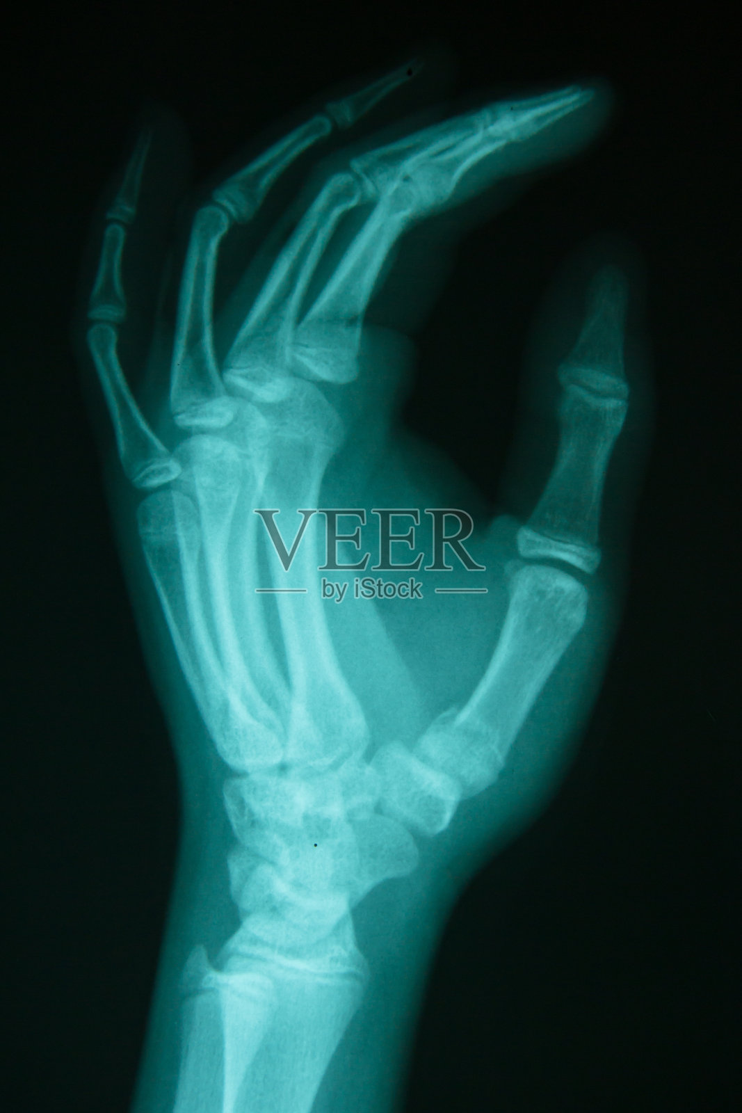 电影x射线的手照片摄影图片