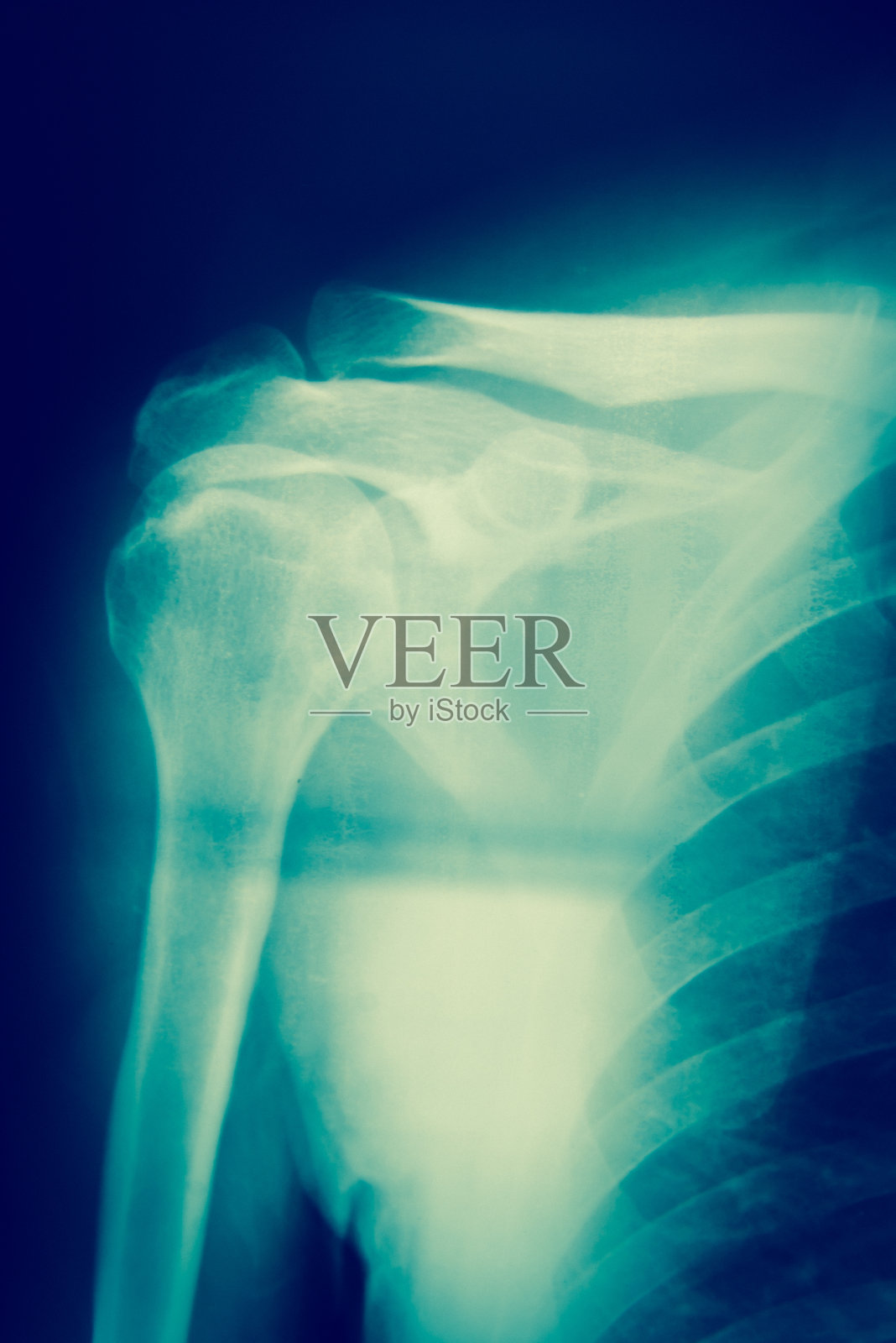 x射线胶片照片摄影图片