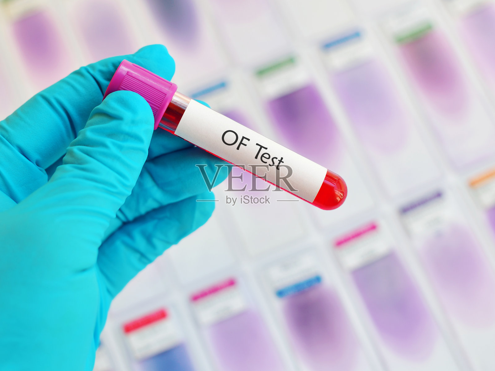 红细胞渗透脆性试验照片摄影图片