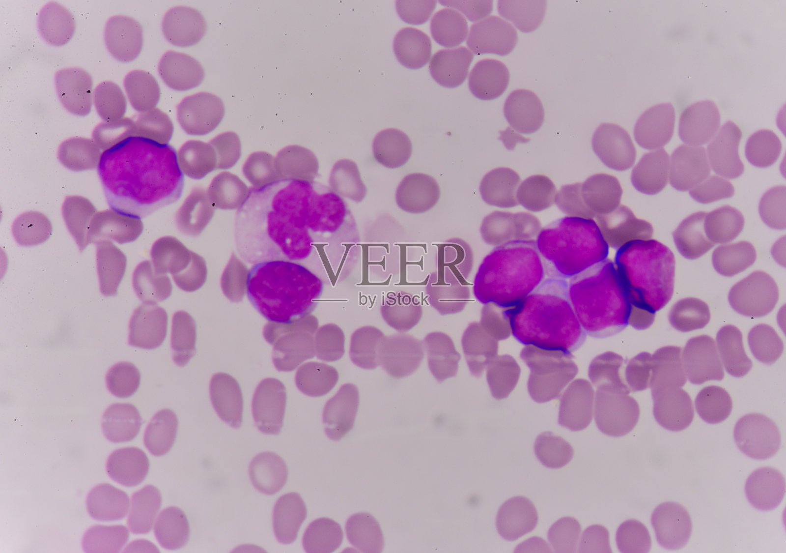 血涂片照片摄影图片