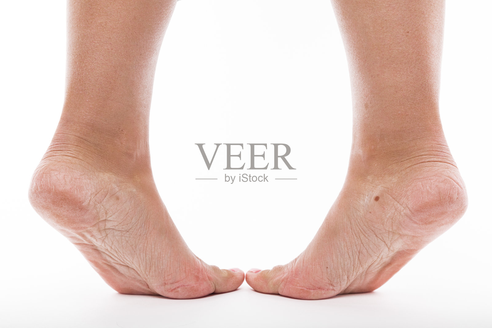 女性脚后跟皮肤脱水照片摄影图片