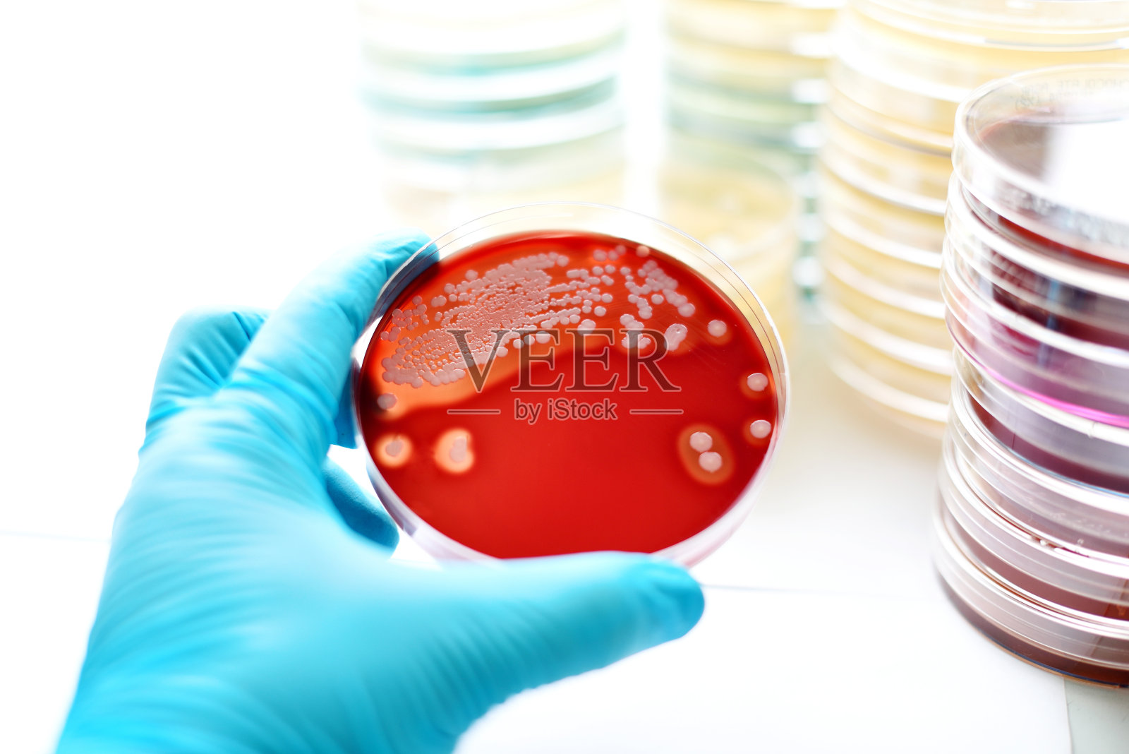 细菌培养照片摄影图片