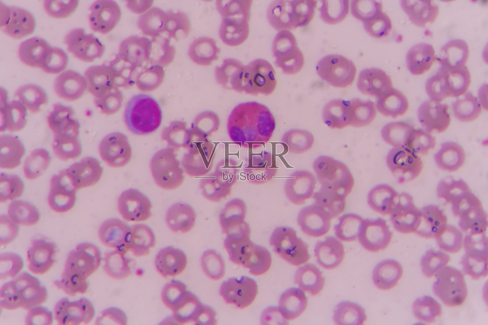 涂片显示嗜酸性粒细胞照片摄影图片