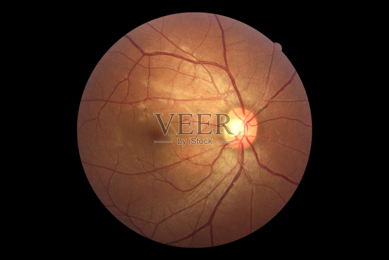 用Mydriatic视网膜相机拍摄人眼解剖图像照片摄影图片