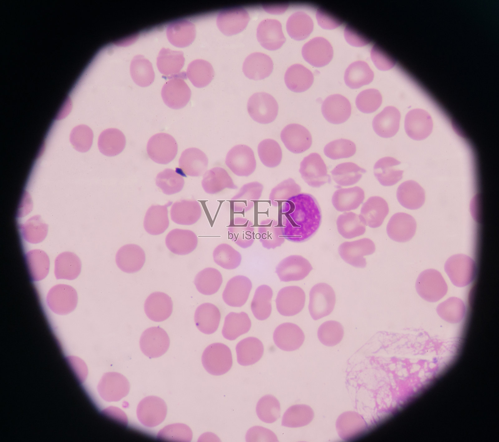 外周血图像中的母细胞。照片摄影图片