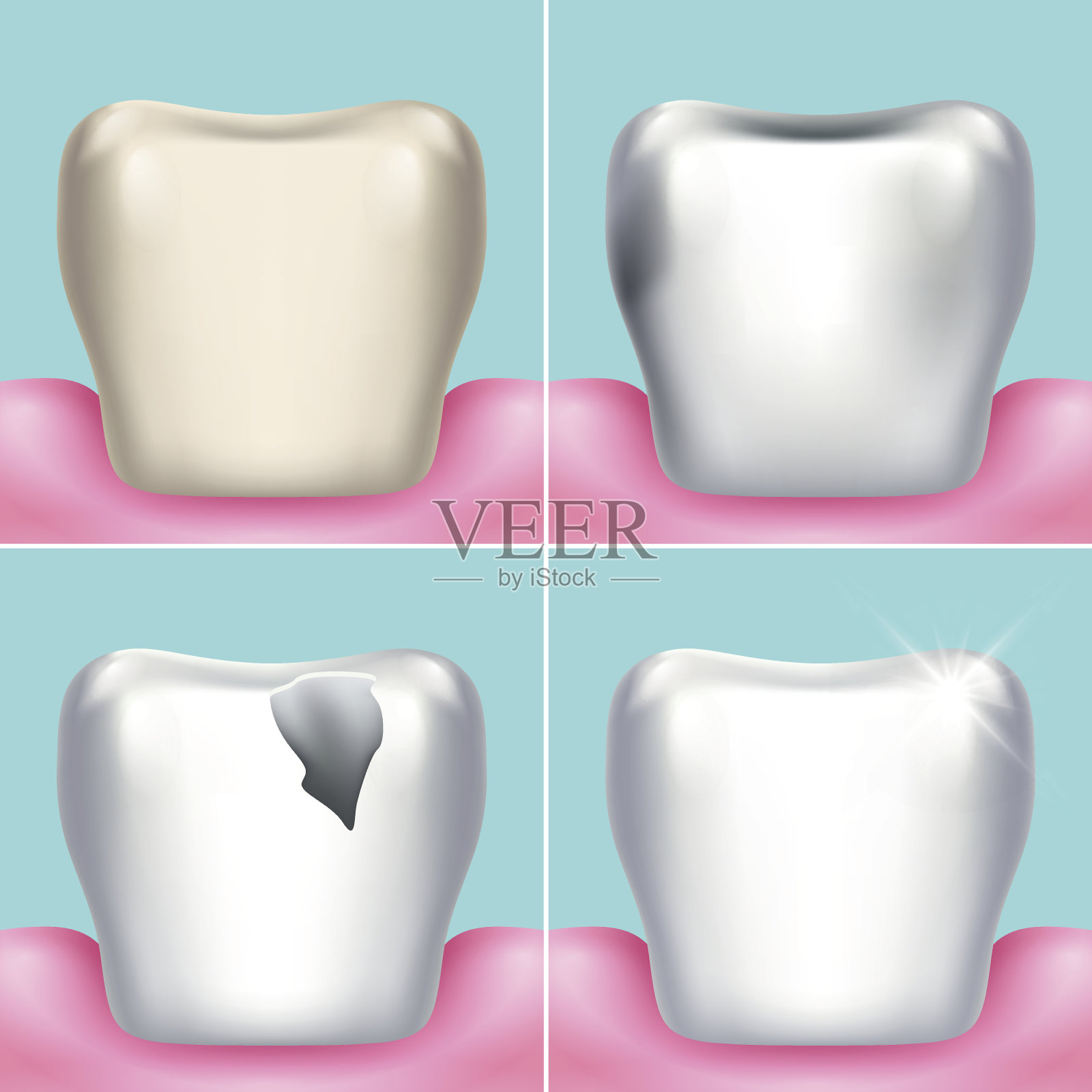 牙齿问题，龋齿，牙菌斑和牙龈疾病，健康的牙齿载体插画图片素材