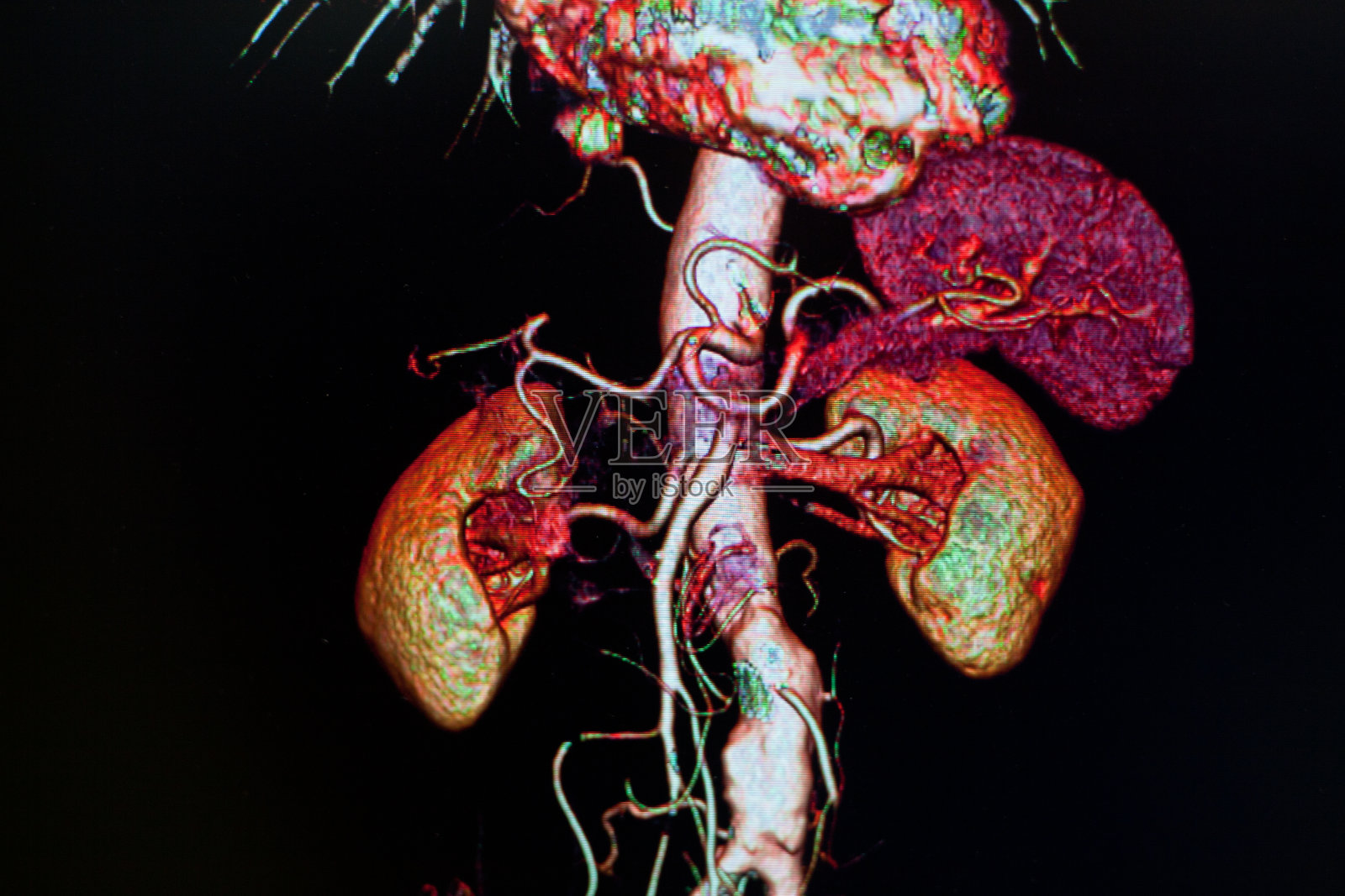 人体解剖与颜色照片摄影图片