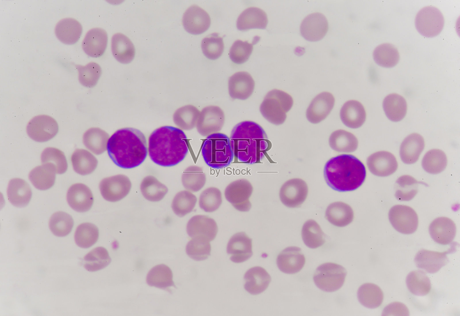 血涂片照片摄影图片