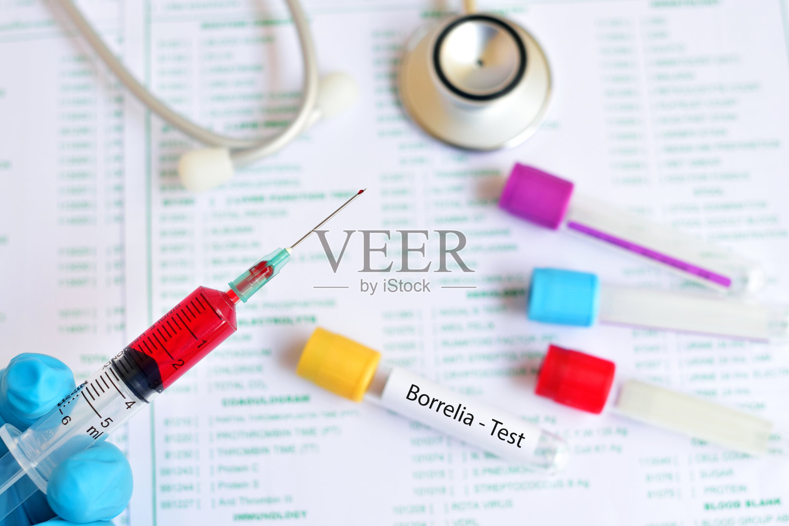 包柔氏螺旋体试验照片摄影图片