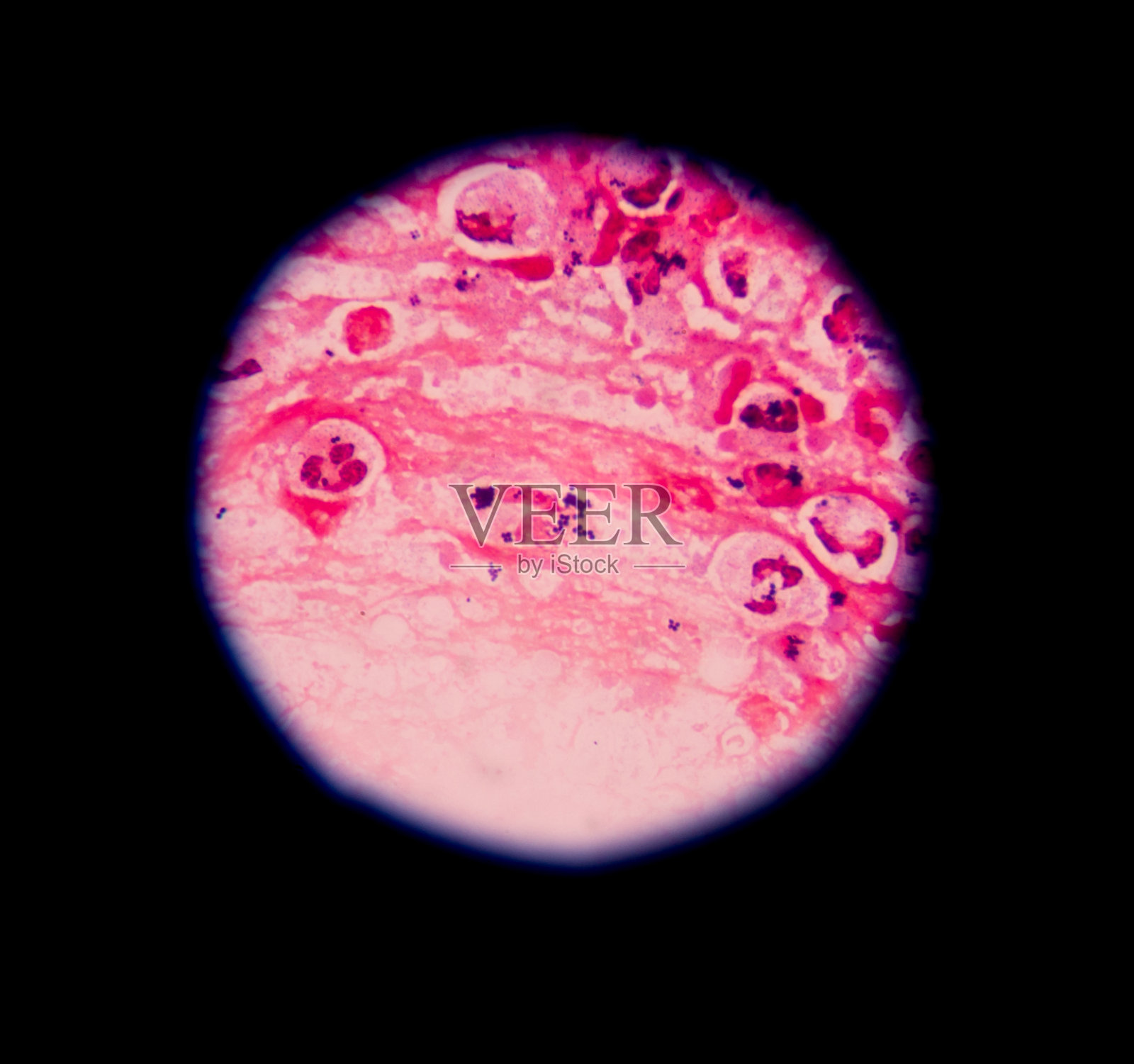 革兰氏染色剂照片摄影图片