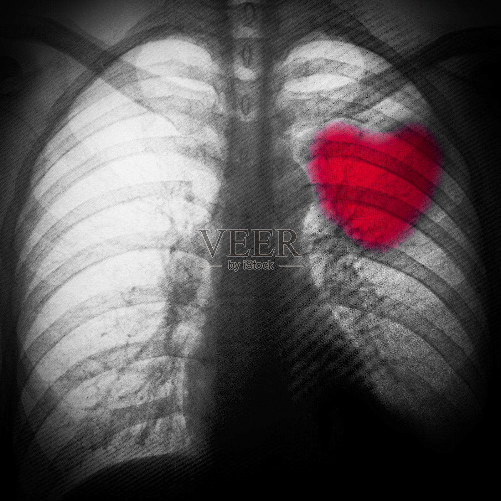 x射线的胸照片摄影图片