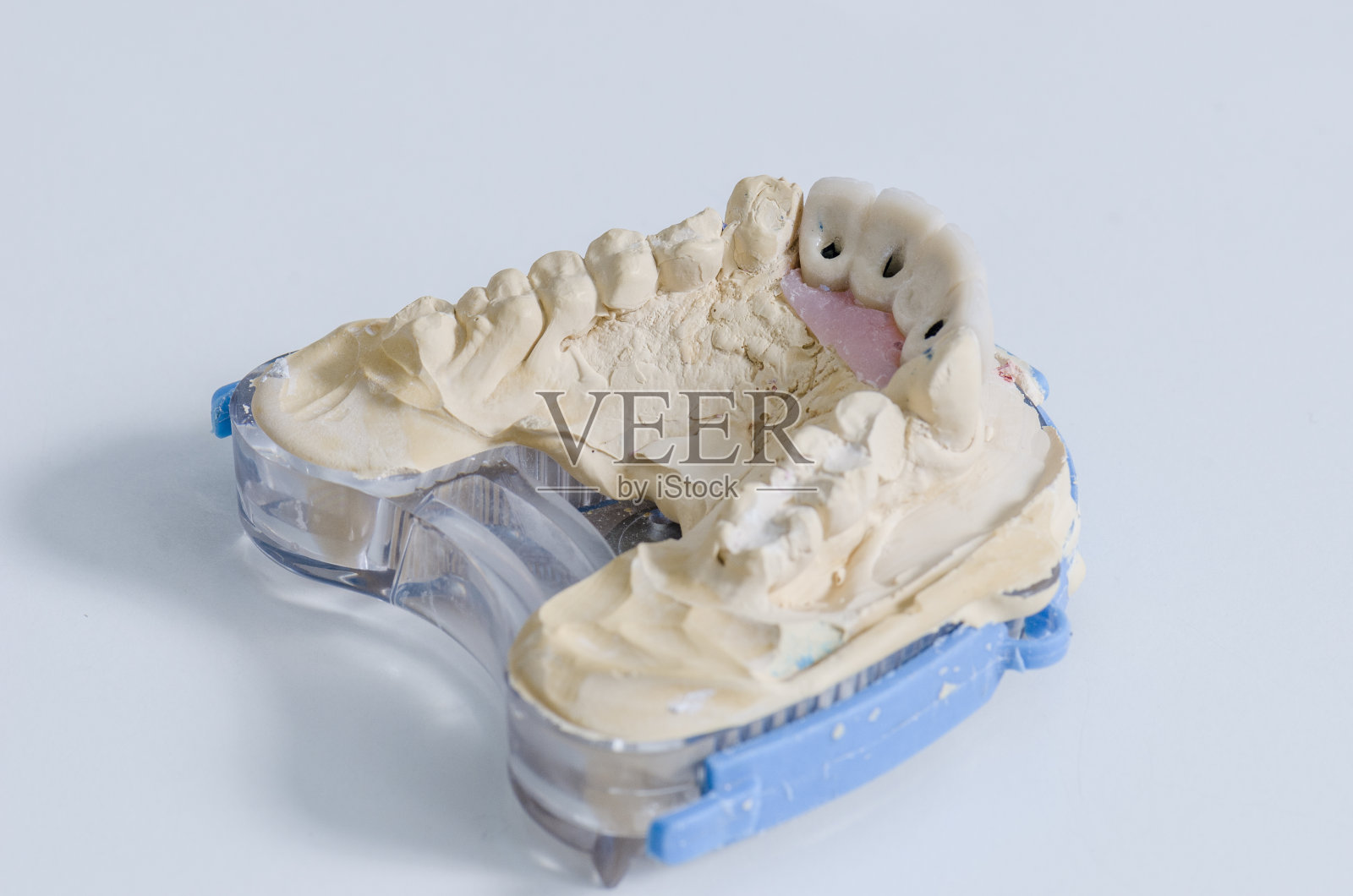 在金属烤瓷冠上工作的牙科技师照片摄影图片