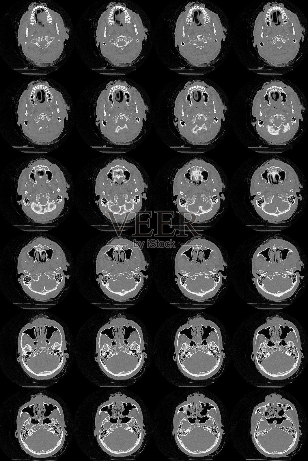 电脑断层扫描大脑的一系列图像照片摄影图片