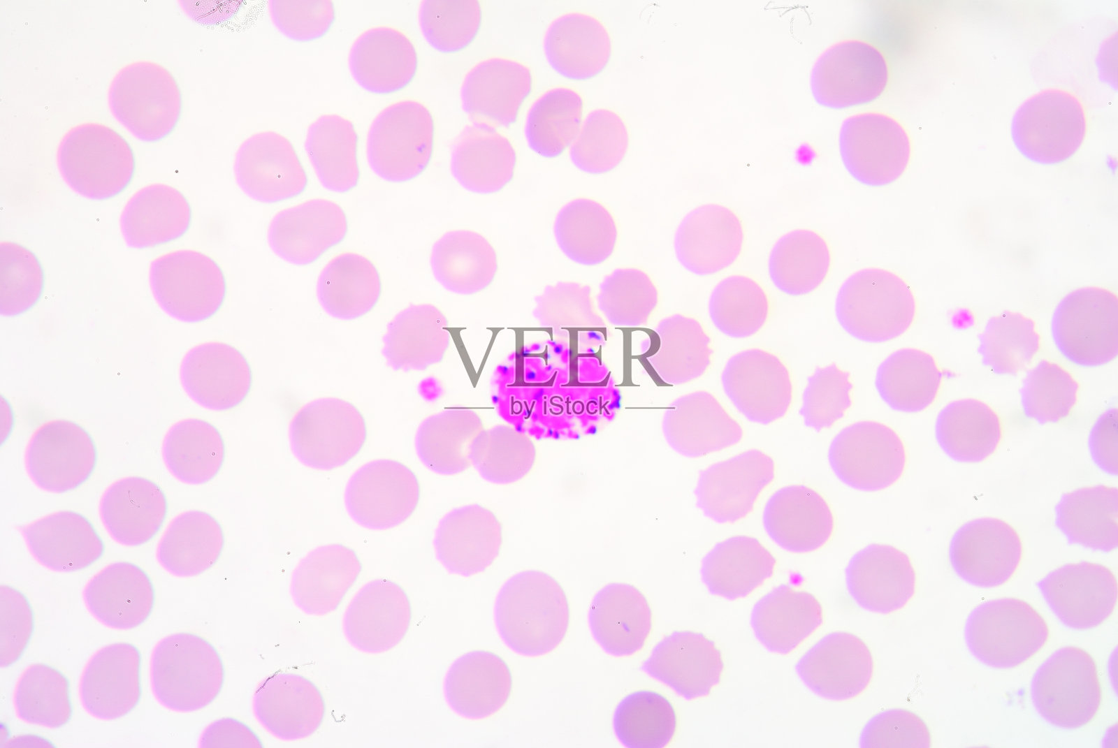 嗜碱细胞照片摄影图片