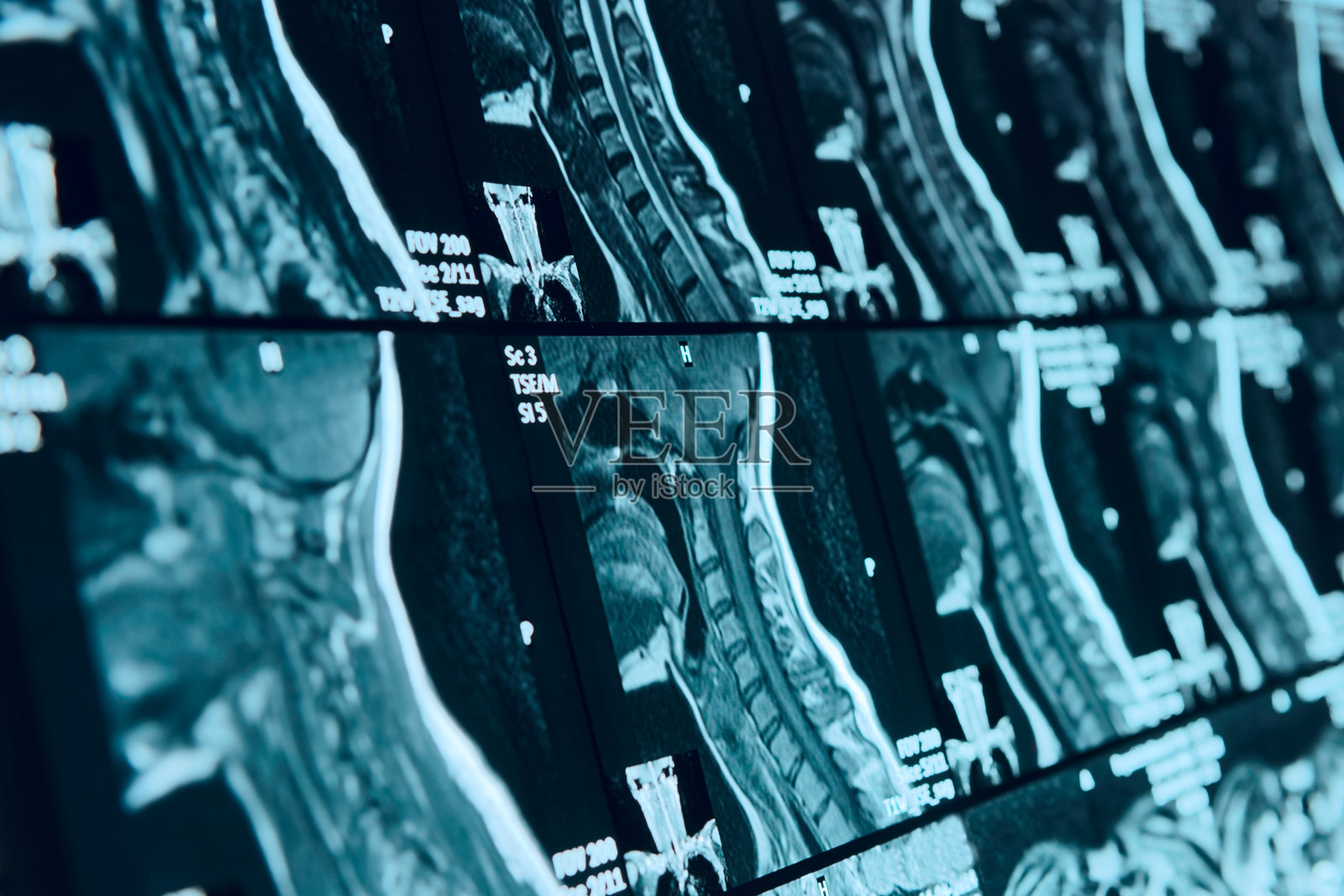 头部和颈部MRI扫描，匿名照片摄影图片