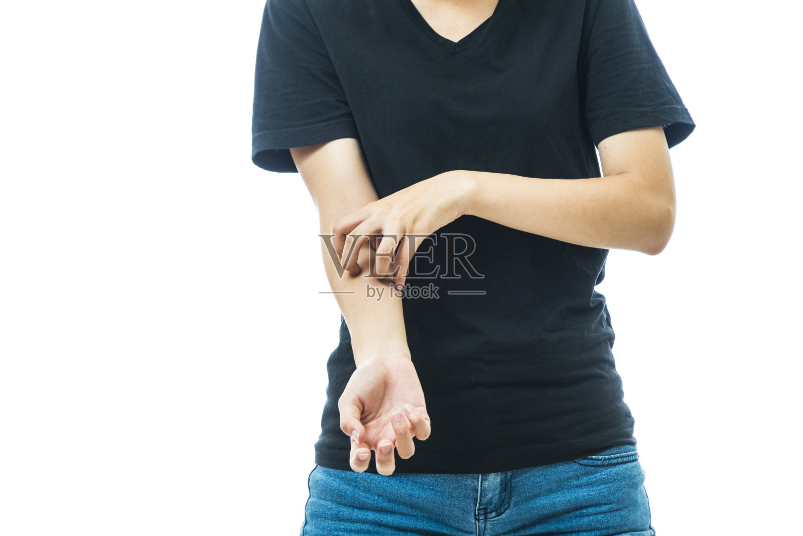 健康问题。一个年轻女子用过敏皮疹挠她发痒的手臂照片摄影图片