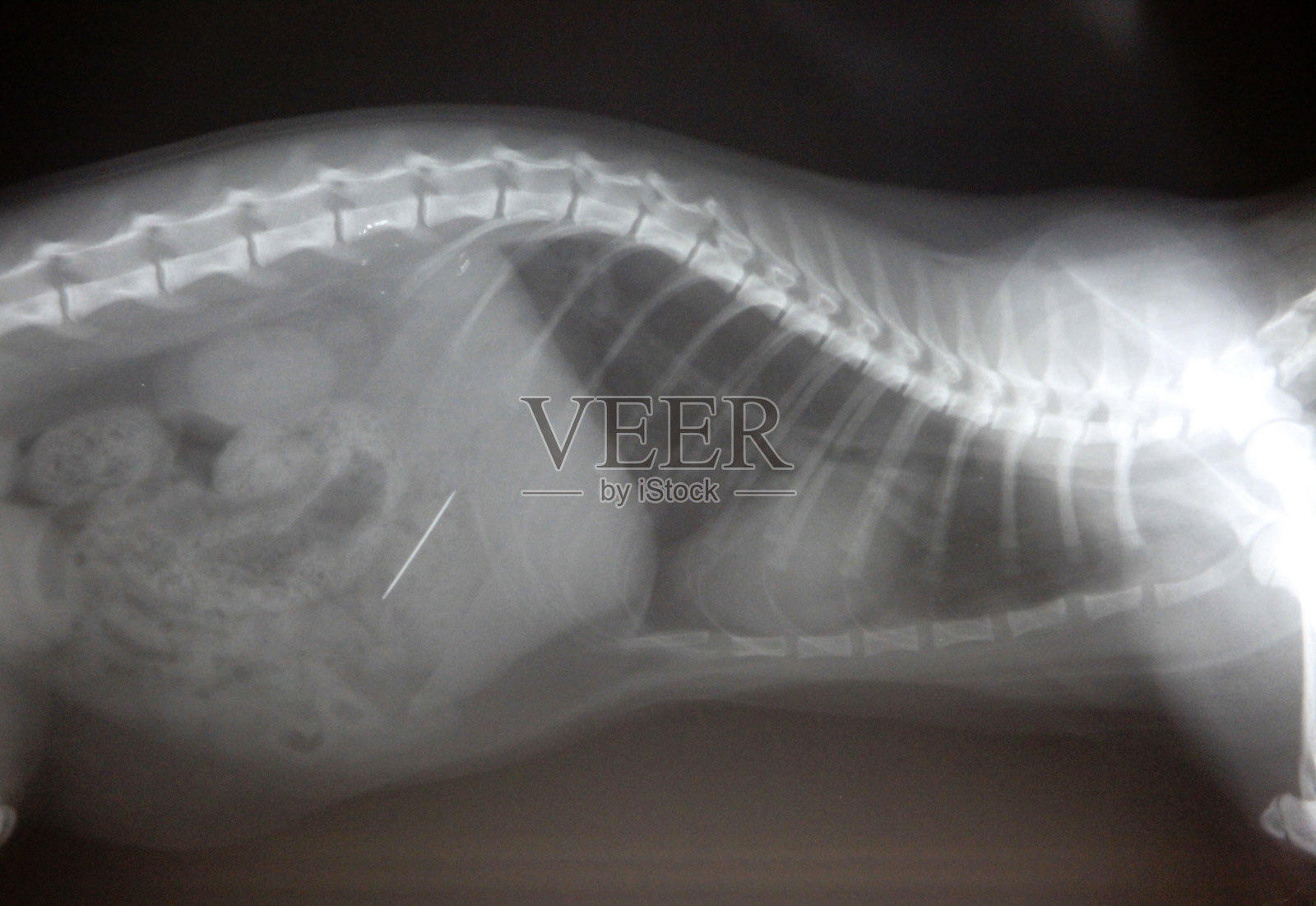 胃针x光片照片摄影图片