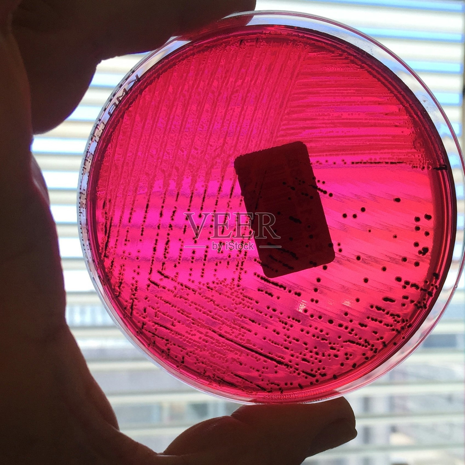 沙门氏菌照片摄影图片