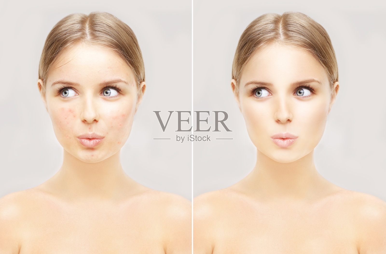 有问题的女孩和干净的皮肤。照片摄影图片