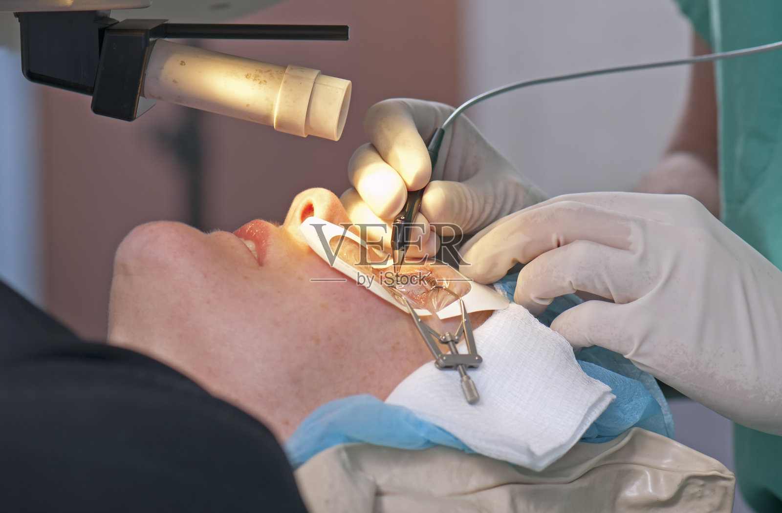 特写：患者接受LASIK眼科手术照片摄影图片