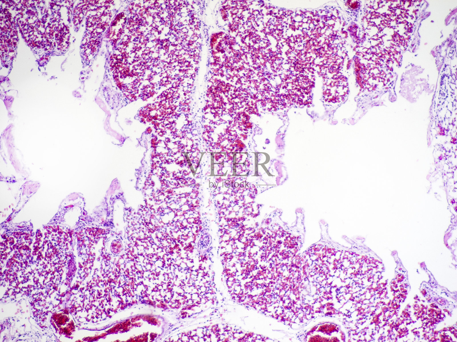 肺组织中的副支气管和隔膜照片摄影图片