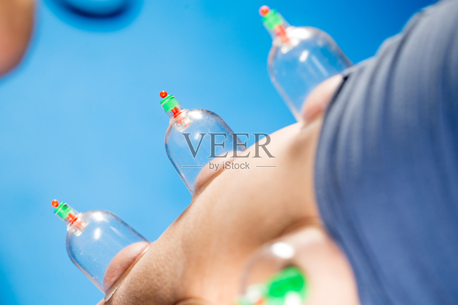 真空拔火罐治疗照片摄影图片