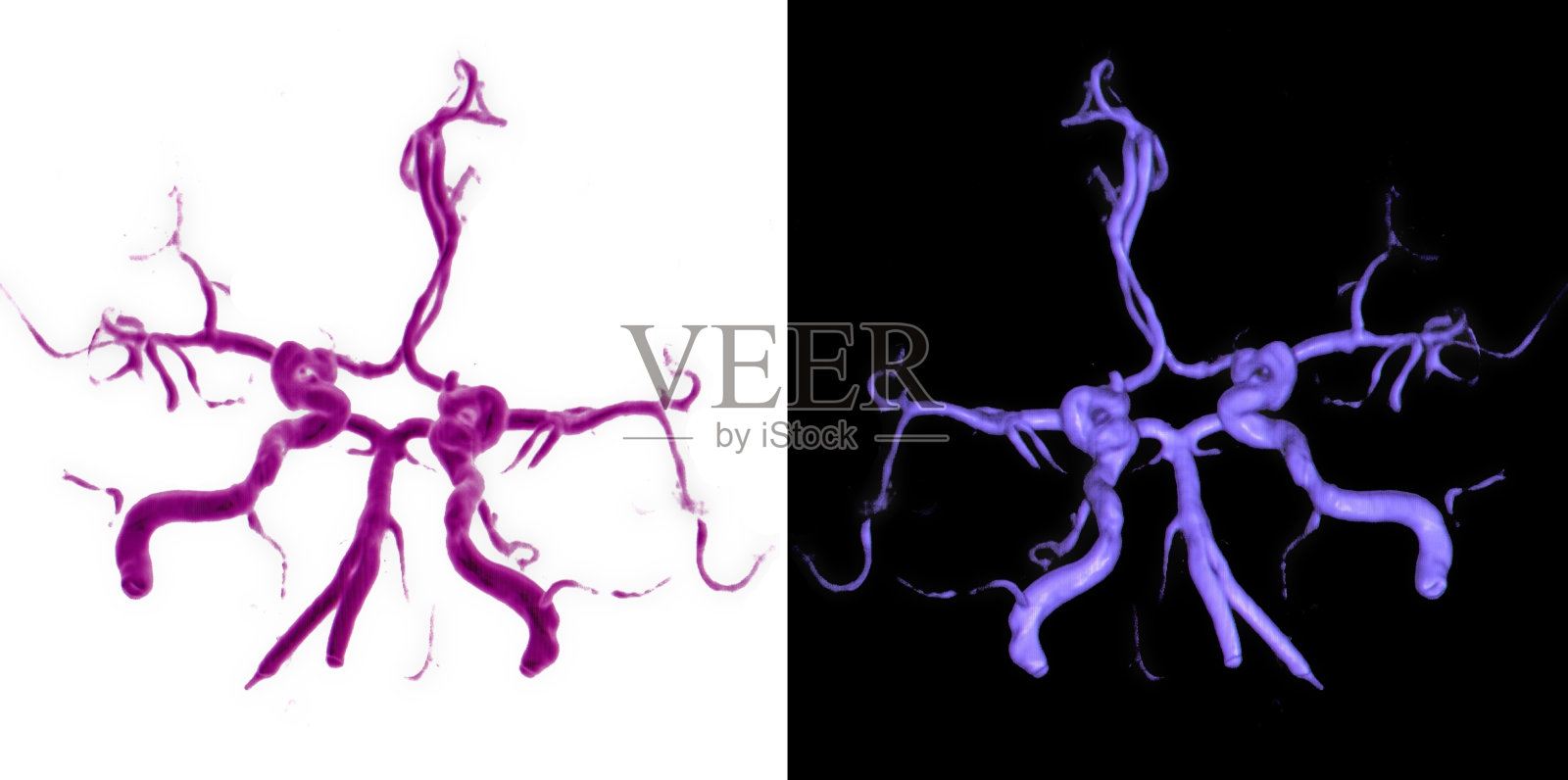 大脑血管造影术先生照片摄影图片