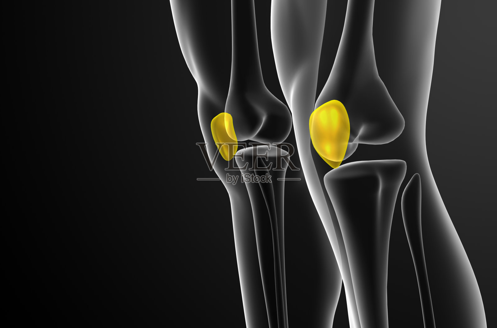 髌骨的3d渲染医学插图照片摄影图片
