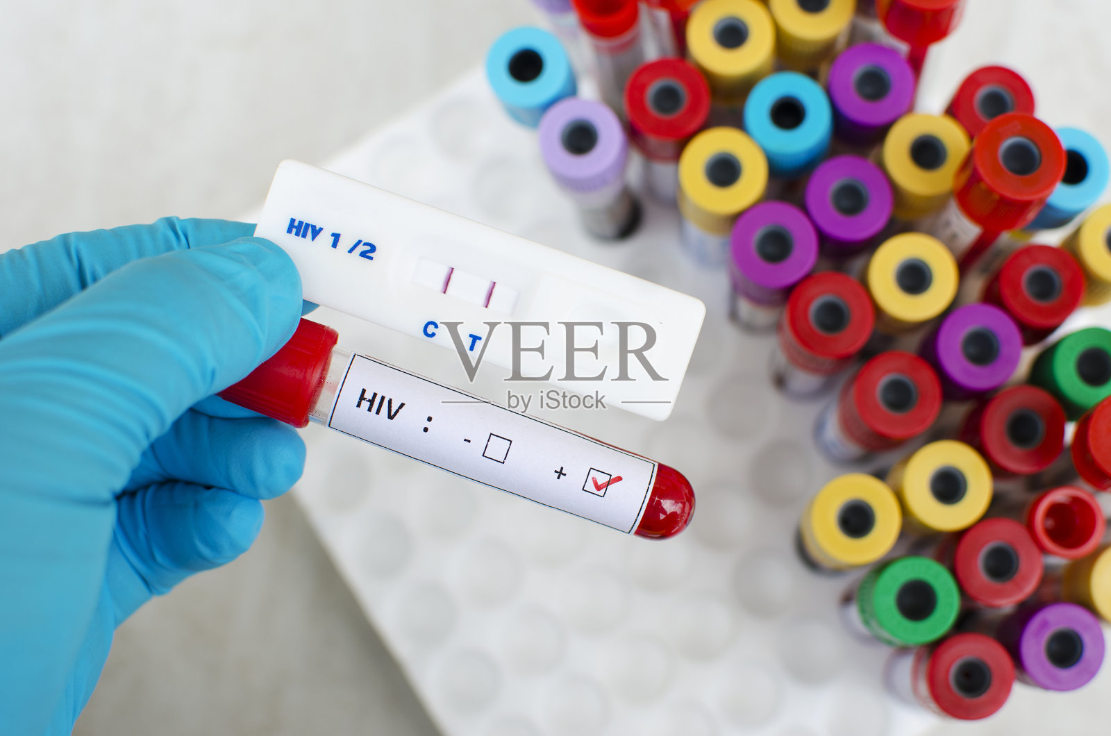 HIV阳性的结果照片摄影图片