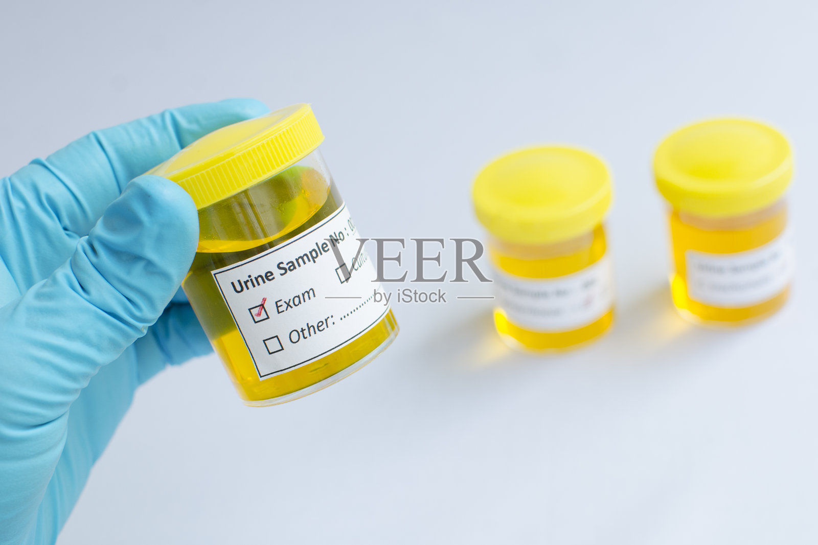 尿液检查照片摄影图片