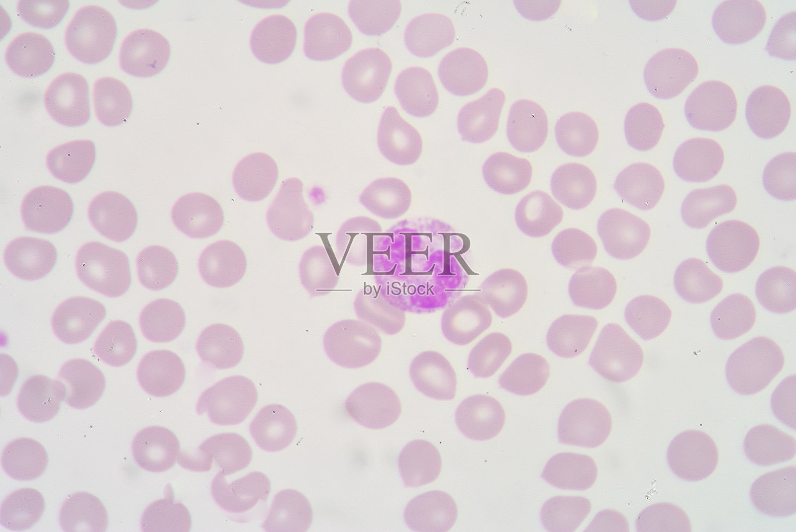 分段Netrophil照片摄影图片