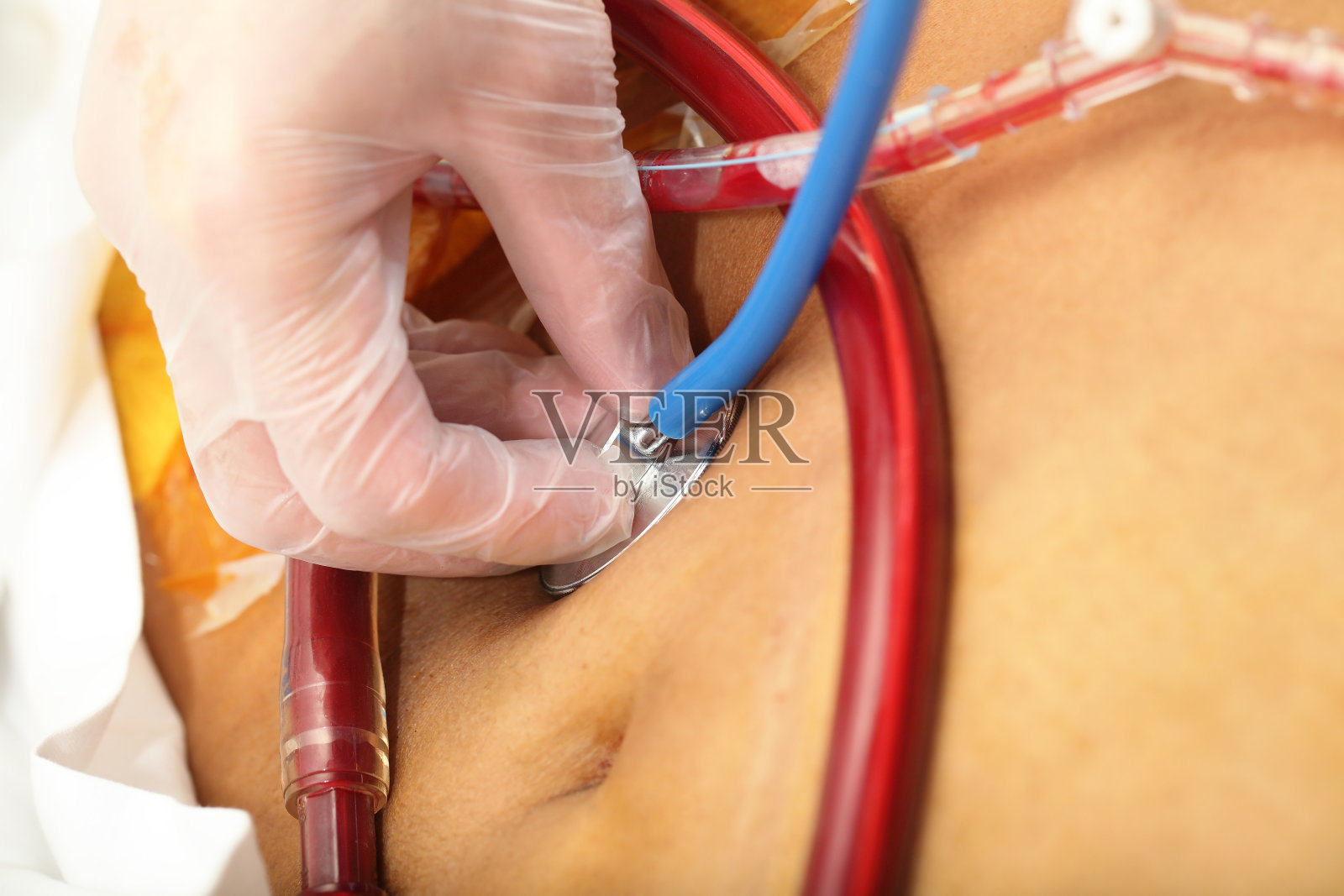 外科医生不知疲倦地监视着病人的健康状况照片摄影图片