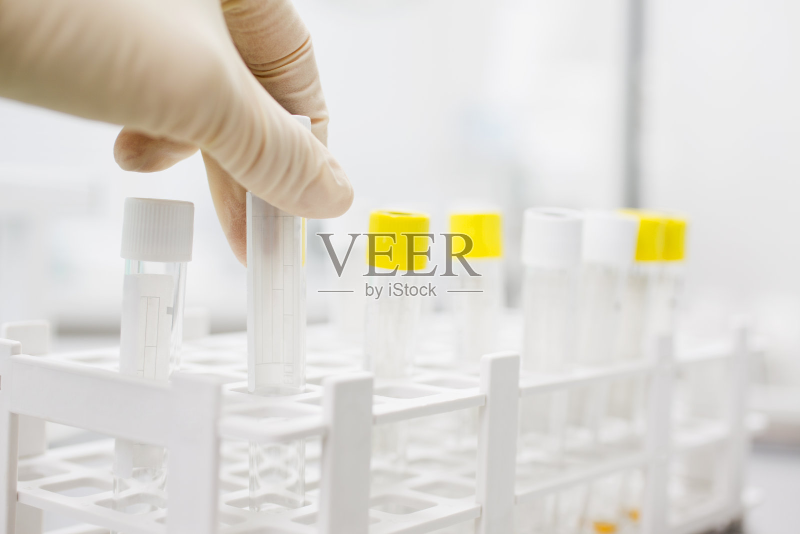 血液试管实验室照片摄影图片