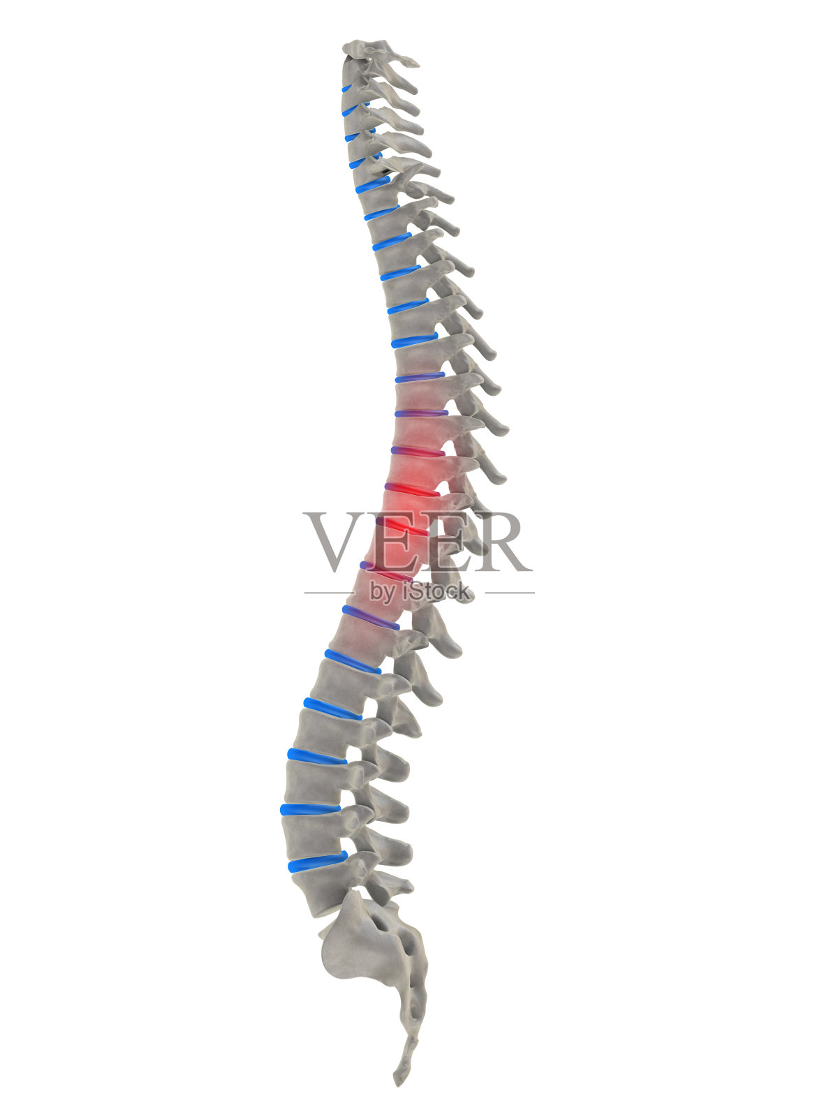 脊柱中部疼痛照片摄影图片
