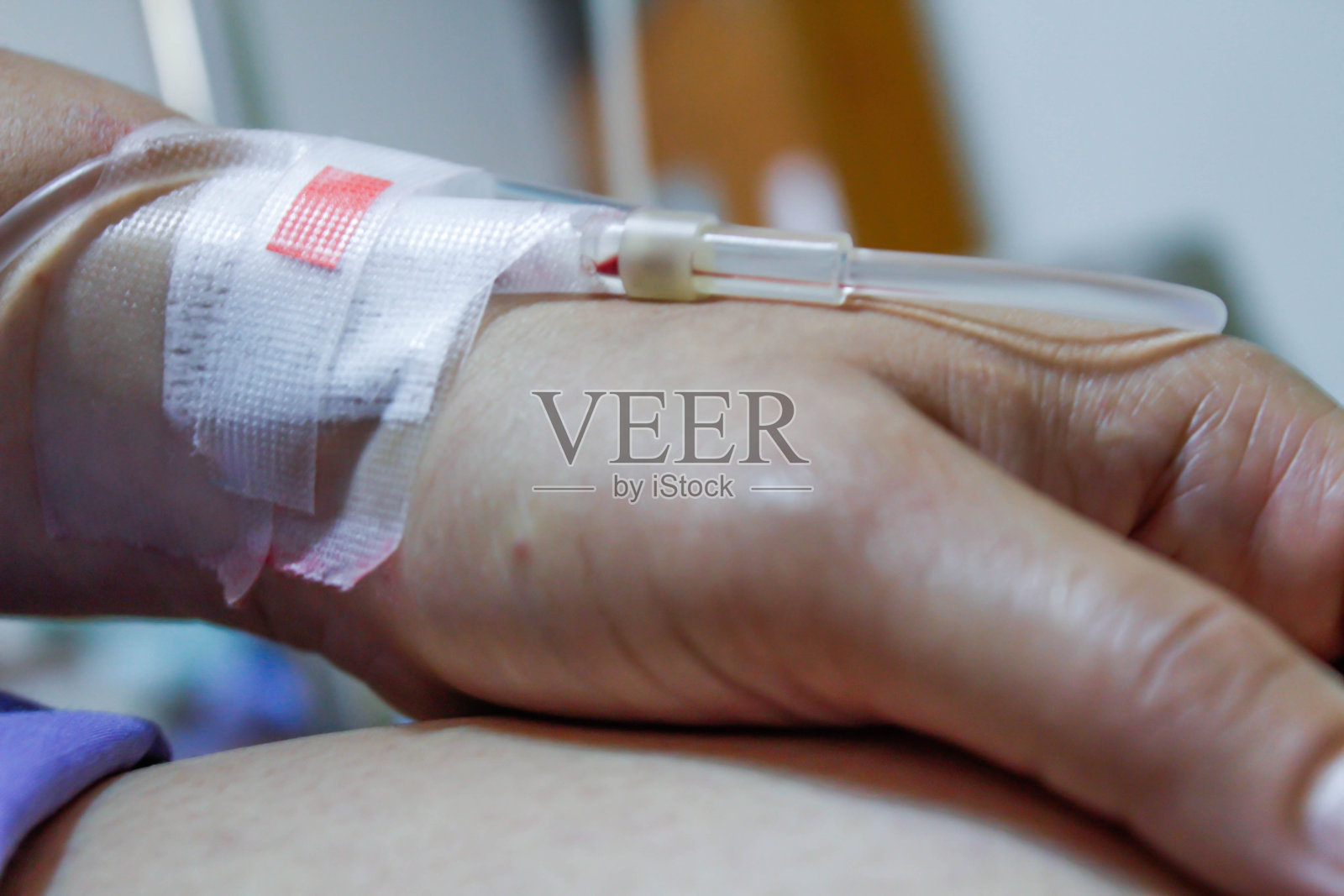 医院里病人手上的生理盐水照片摄影图片