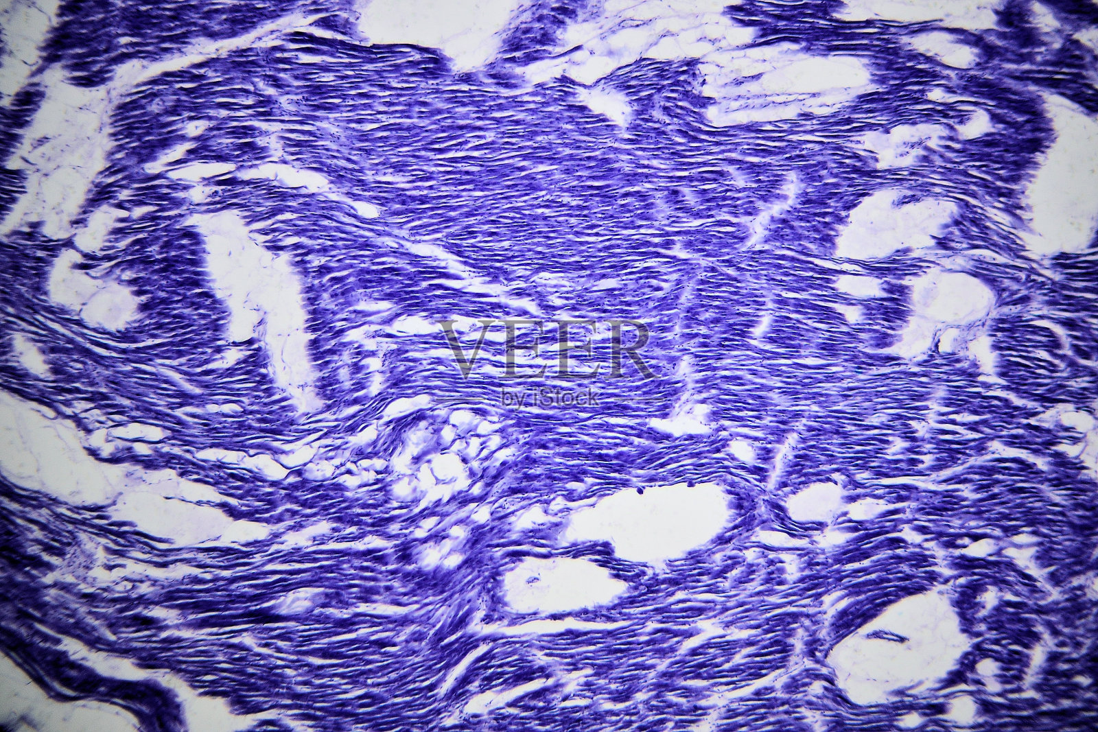 显微镜下的人类心肌照片摄影图片