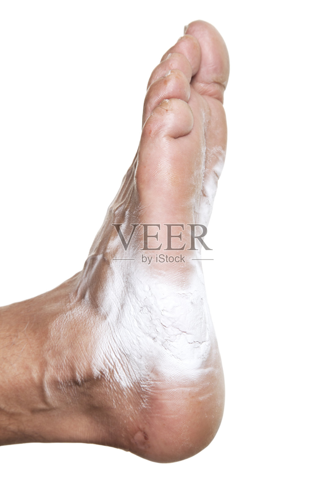 受伤的人脚照片摄影图片