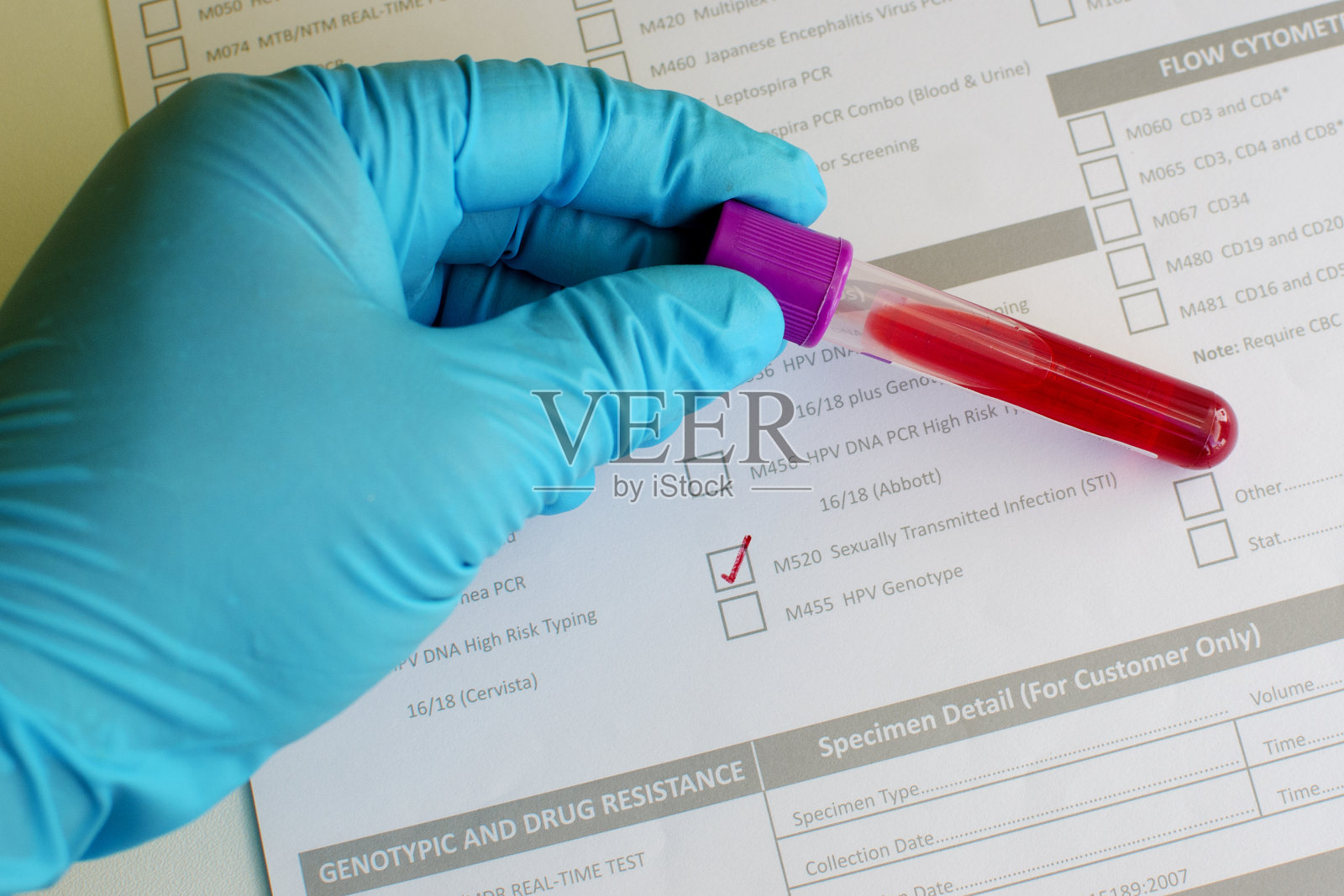 性传播疾病照片摄影图片