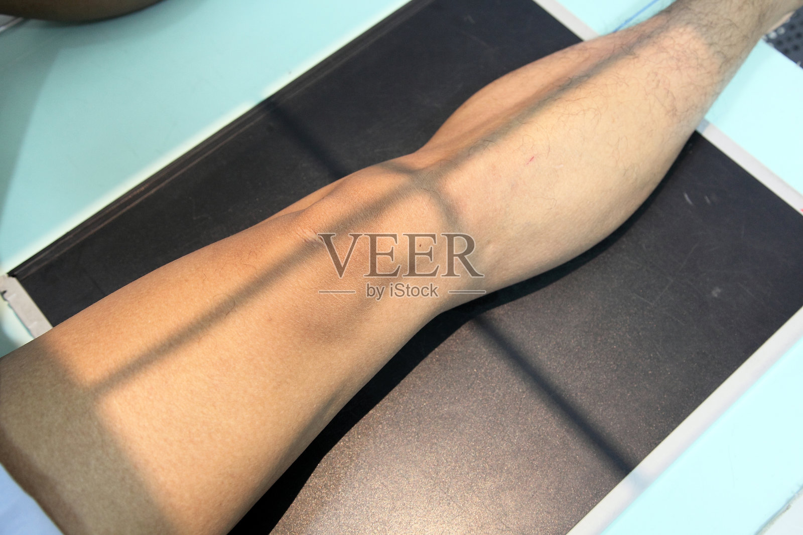 X光定位照片摄影图片